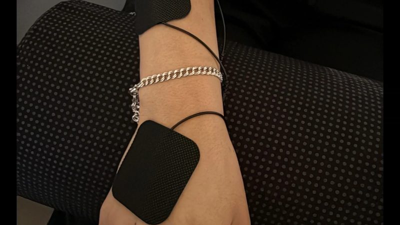 Electrical muscle stimulation therapy pads applied during a treatment session